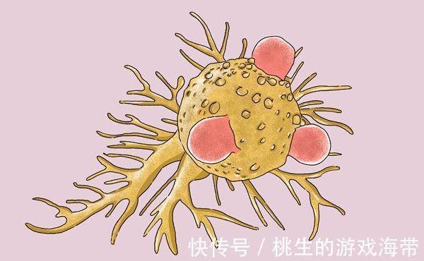 手术切除|癌症切除后，一年不到就复发了？医生和您分析下原因