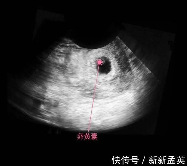 胚胎|胎儿从卵泡到性别形成,17张图片清晰诠释,男宝女宝看得很清楚