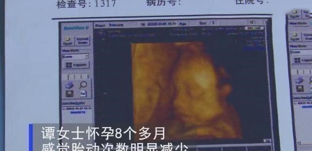 产检|胎儿缺氧后果严重，3个方法判断“是否缺氧”，孕妈们别大意