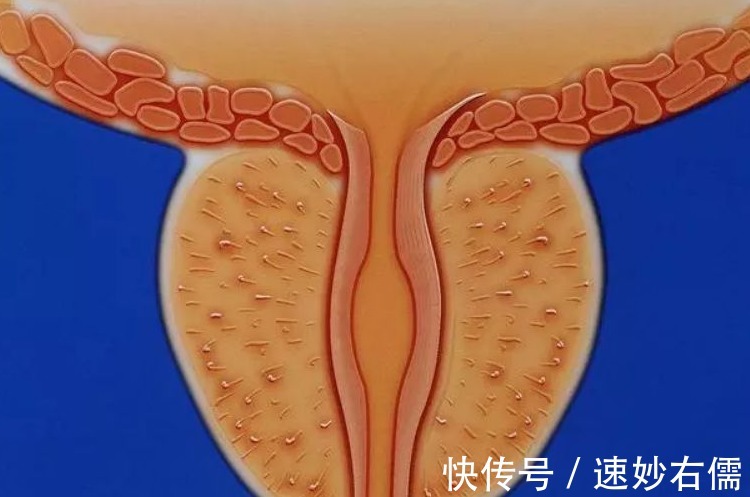 会阴部|男人的下身有2个疼痛,前列腺或已“千疮百孔”,应趁早就医