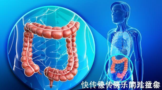 大便|肠癌都是拖出来的？有这3个表现，是肠道在求救！越早做肠镜越好