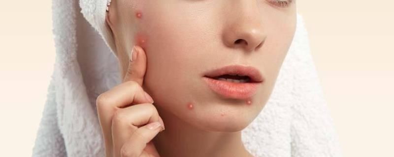 脸上长痘先涂药还是护肤品