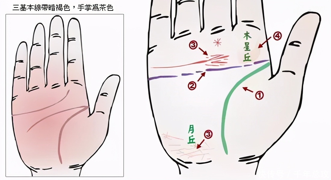  诊断|掌纹可以诊断肝癌、糖尿病、高血压、妇科病、脑溢血