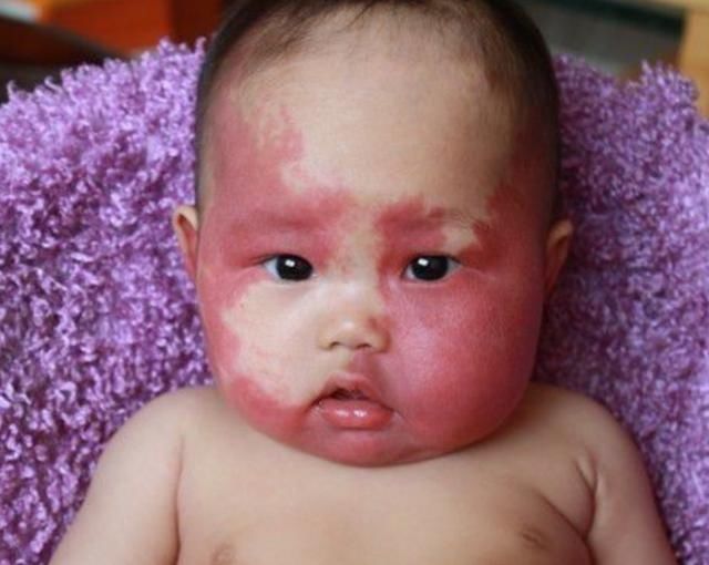 孕妇|孕期这3种行为,会导致胎儿带痕迹出生,想要孩子颜值高得避免