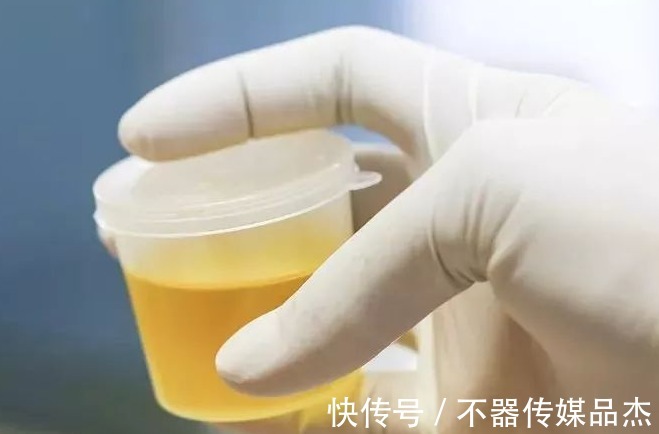 男人|男人前列腺好不好,上个厕所全知道,若出现一个,要尽早收手