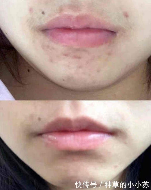 大牌|不会“踩雷”的4款护肤品,卖不了高价钱,效果却不输大牌