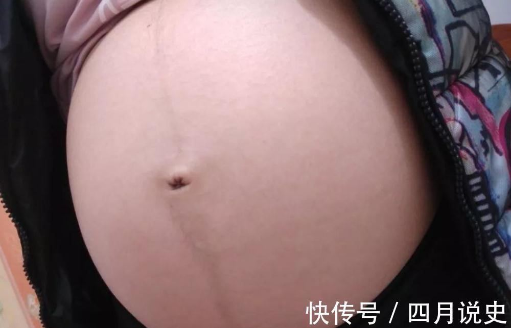 胎毒|孕妇体内胎毒太多,会有什么表现?只要有这三个信号,就该排毒了