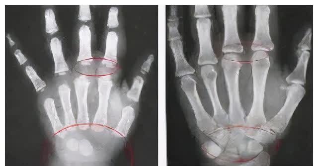 身高处|最新儿童标准身高表,你家孩子达标了吗?3大误区家长别大意