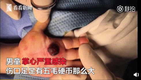 鸽子粪|吞蝌蚪、喝蟑螂水、吃鸽子粪……你被“偏方秘方”坑过吗?