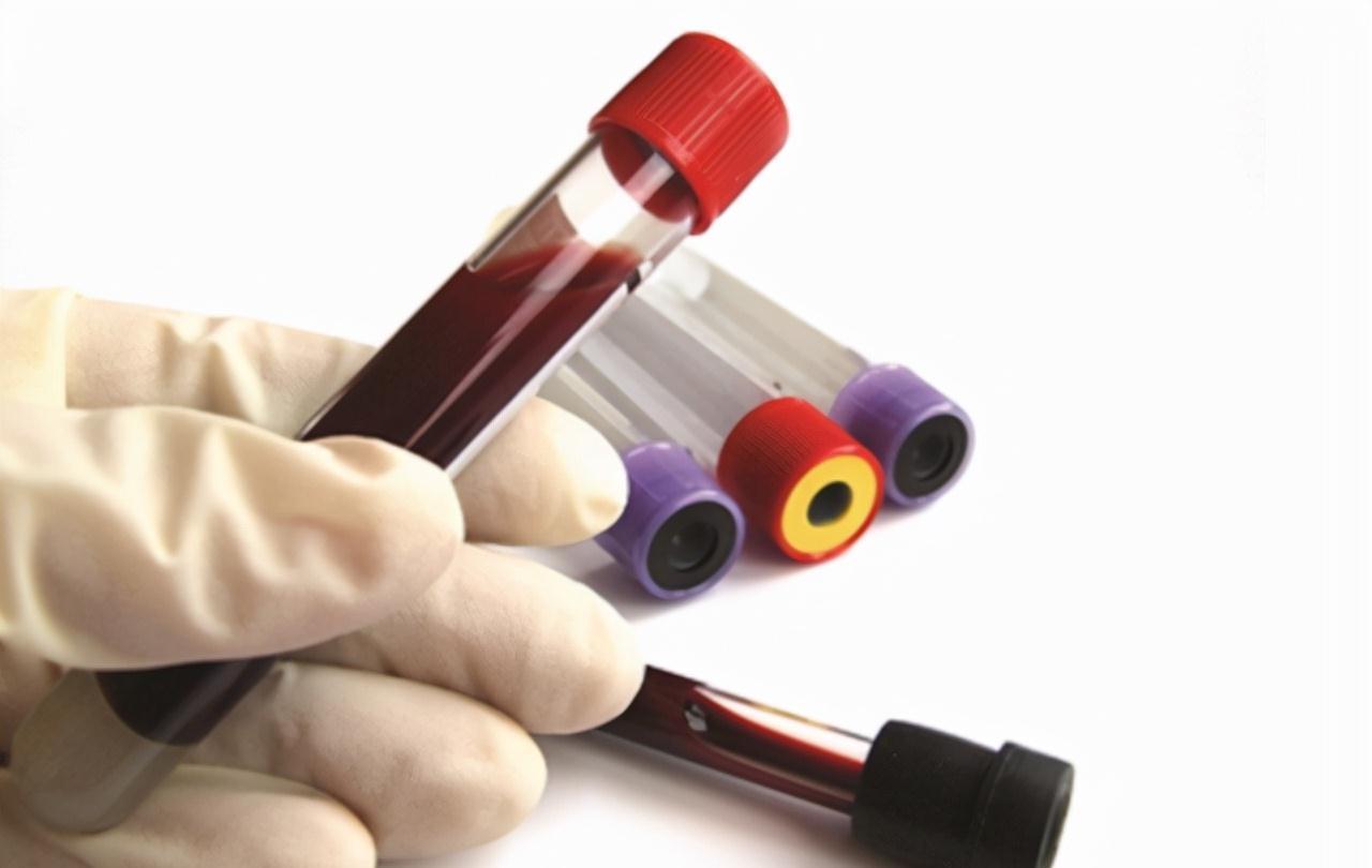 宋大爷|空腹血糖小于7.0,说明不是糖尿病?医生说答案,别再骗自己