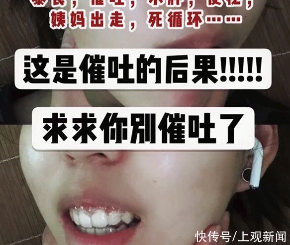 臨床心理科|女子為減肥竟將塑料管插入胃里50cm，催吐管在電商平臺公開售賣