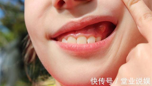 枸杞泡水|常喝枸杞水养肝强身,但要避开四个禁忌,为了健康,花时间看看吧