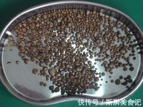 甘草汤|小方治大病,细说芍药甘草汤的10大妙用,老中医都忍不住点赞!