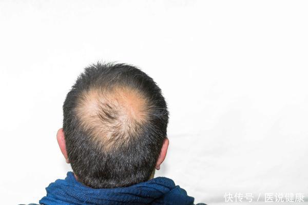 男性|男人步入衰老时,身体会有5个共性,若你符合,该进行保养了