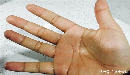 專(zhuān)家|脾虛百病來(lái)擾!該如何判斷脾虛?專(zhuān)家:牢記3個(gè)提醒就好