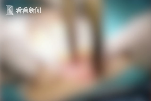 便秘|听信偏方治便秘 他将20厘米长黄鳝塞进了肛门