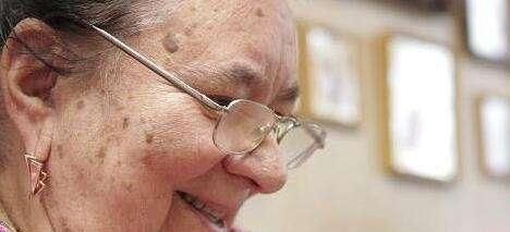 为什么女性脸上容易长斑点？找到原因了，3种办法让自己慢慢变美