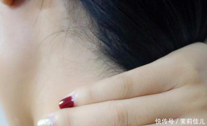 小陈|19岁女孩查出肺癌，医生脖子上有2个现象，可能是肺在“呼救”