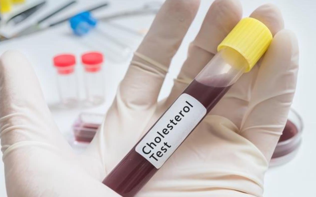 血脂异常|甘油三酯高，什么方法能够迅速减低2个具体实例，教你综合调理