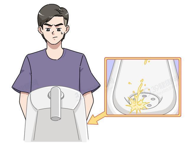 压力性尿失禁|别不好意思:盆底肌训练真的很养生!锻炼持久力,男女都获益