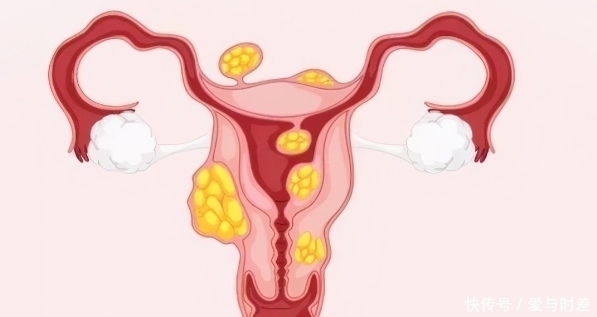 女性|子宫钟爱“水”不是蜂蜜水,坚持喝,给子宫洗洗澡,缓解炎症肌瘤