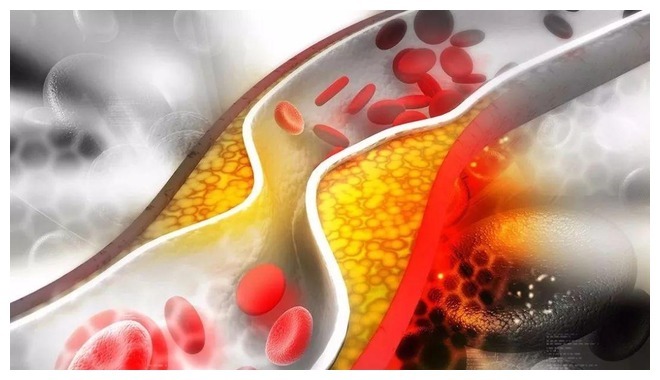 标准|新血糖标准已公布，不是3.9-6.1，是这个范围，自查一下你高吗