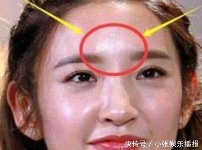 青春期女生总是“油光满面”教你3个小妙招，从此做个“清爽美人”