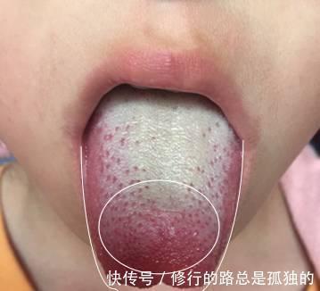 生冷食物|孩子积食不长个,宝妈做了两方面调整,娃一年内长高了二十五厘米