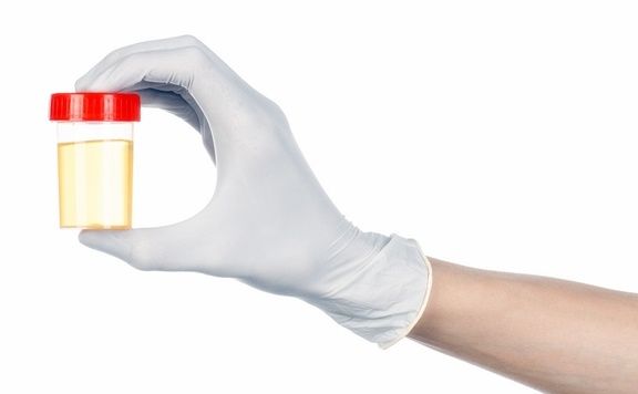 血糖|糖尿病患者的尿又黄又骚是什么原因？你真的知道吗？看专家的理解