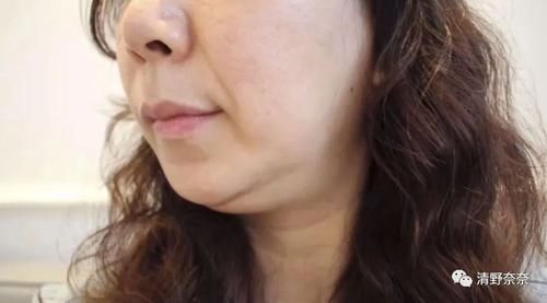 这些变化代表你老了!韩国女生最怕的5个老化现象