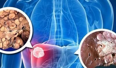 肝不好的人, 这几种天然养肝食物要多吃, 肝脏越吃越干净!