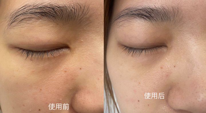 精准|功能型面膜VS补水面膜，精准和精简之间你选对了吗