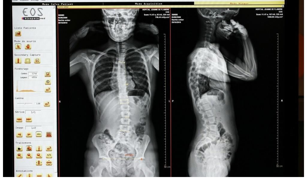 燕麦片|世卫组织呼吁停止食用：比烟酒还伤骨，转告亲人：尽量少吃