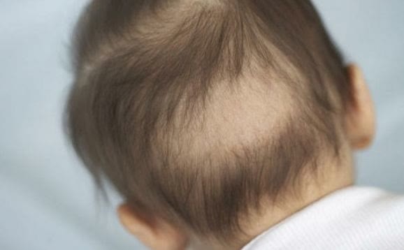 顽固性湿疹|13岁初三男孩一年身高增15CM,1物有助身高“增长”,秋季可多吃