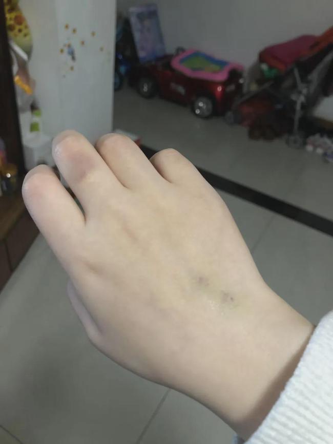 孩子|妈妈拼了!给孩子打生长激素、脊椎埋线花了18万,回头一看全是坑