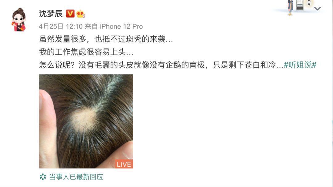 头皮长肉疙瘩不痛不痒