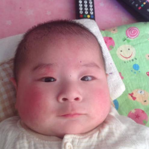 过敏|4种水果并不适合孩子吃,看似营养高,吃多了却是隐藏的危害