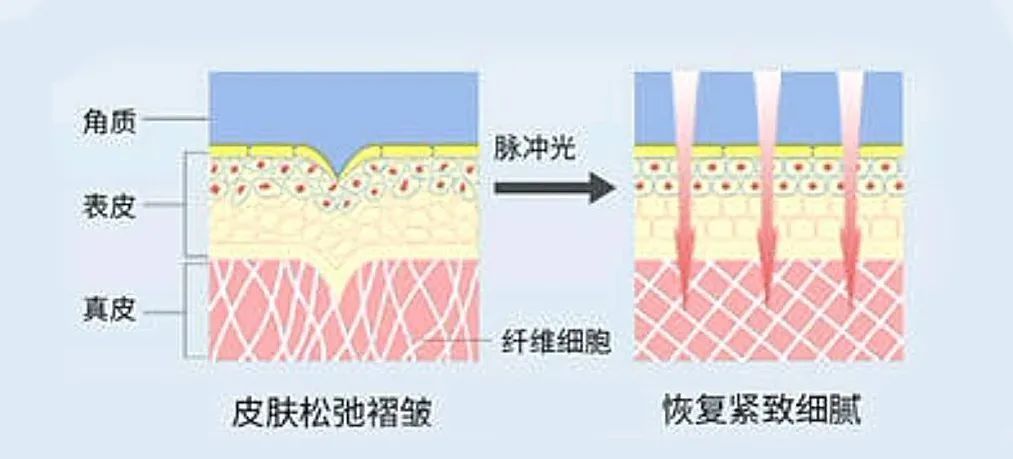 眼科医院|春节前这波操作，让TA刮目相看！