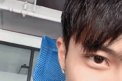 逼疯强迫症的一单一双眼皮，手术能不能只做单侧？