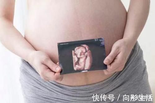 四维|为何有的医院做四维彩超不让家属陪?3大原因,孕妇有权知道