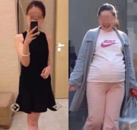 宝妈|妊娠纹是如何形成的丈夫们都该来看看,母亲的苦难应该被理解