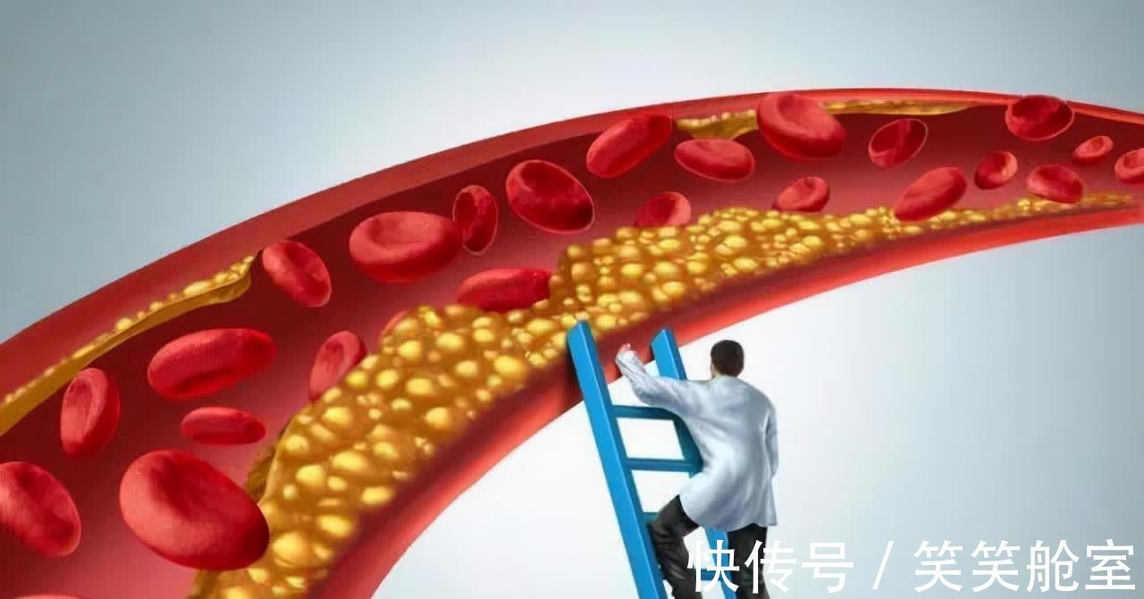 营养师|天天吃坚果会患高血脂?营养师建议:3种坚果最好少吃