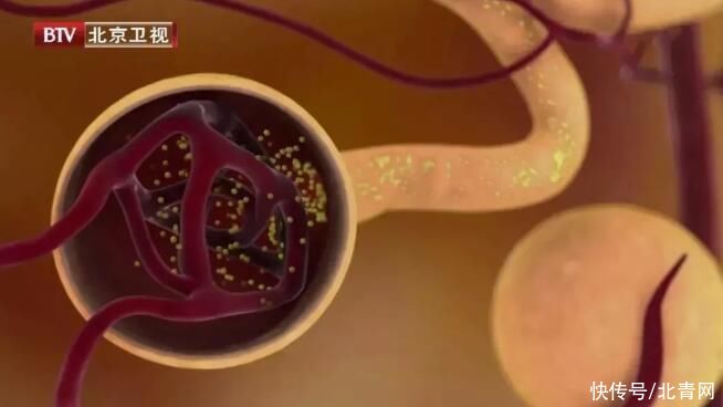 尿毒症|每10人就有一个慢性肾病,日常6大因素太伤肾