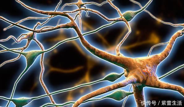 老年痴呆|老年痴呆最新检测题:3个全对的恭喜!大脑年轻,晚年生活不用愁