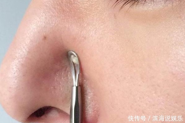 “肝毒”太深,“脸上”有3种表现,排除肝毒,按一穴、吃三蔬