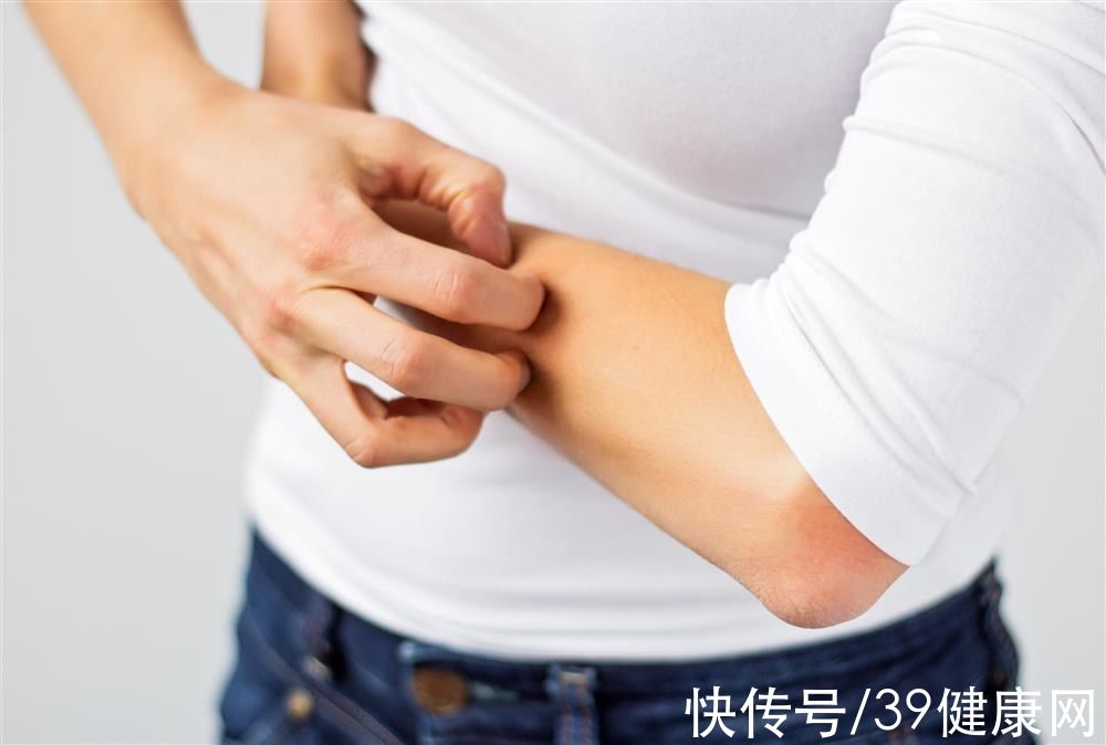 癌变|皮肤上的小肉球、小肉疙瘩是什么？别忽视，小心是感染了HPV