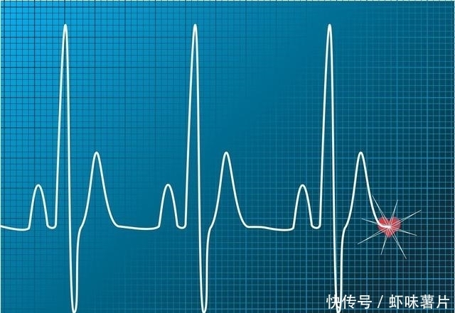 心跳快好还是心跳慢好?心跳多少心脏寿命更长?医生告诉您答案