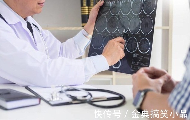 医生|医生忠告一旦身体有这一症状,十有八九脑中风,要立即呼120