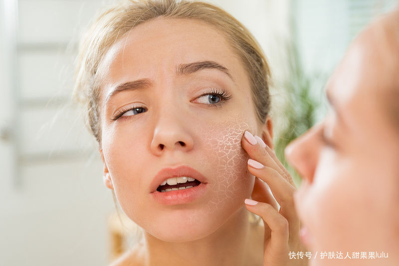 脱皮|好雨时节:干性皮肤—脸上总起皮怎么办?