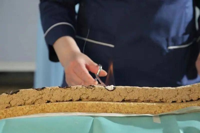 三伏灸|三伏天做三伏灸 能治哪些病?适合哪些人?【浦东医生话养生】